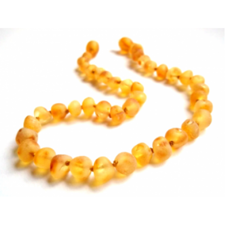 Raw Amber Necklace (ANR Honey)