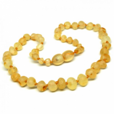 Raw Amber Necklace (BTNR Honey)