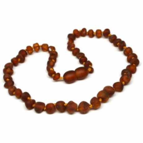 Raw Amber Necklace (BTNR Cognac)