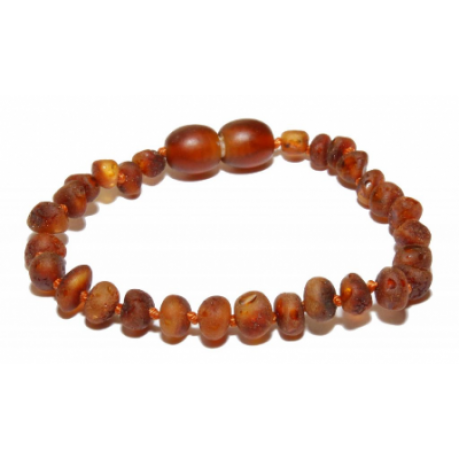 Raw Amber Bracelet/Anklet BTAR Cognac (BTAR Cognac)