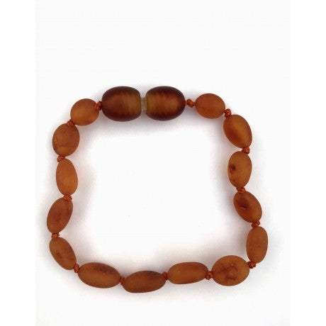 Raw Amber Bracelet/Anklet (BTABR Cognac)